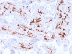 Factor XIIIa Antibody (F13A1/3772R) - Azide and BSA Free, Novus Biologicals